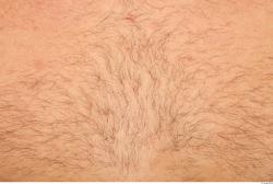 Hairy Skins